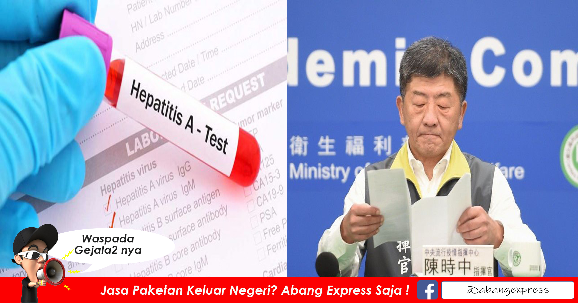 Read more about the article Waspada, 18 Pekerja Migran di Taiwan Terkonfirmasi Hepatitis A, Ini Gejalanya